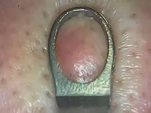 Load and play video in Gallery viewer, Smart Skin Pore Remover