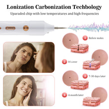 Load image into Gallery viewer, Skin Tag Remover Plasma Pen