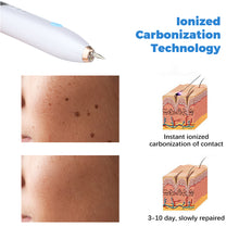 Load image into Gallery viewer, Skin Tag Remover Plasma Pen
