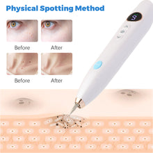 Load image into Gallery viewer, Skin Tag Remover Plasma Pen
